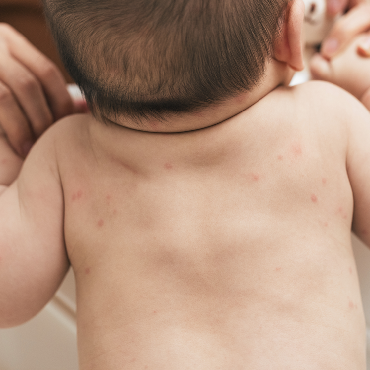 Why Fragrance-Free Matters for Sensitive & Eczema-Prone Skin